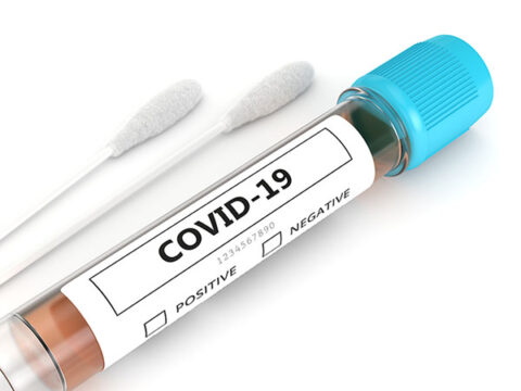 COVID-19 swabs and test kit