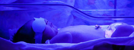 baby with jaundice in hospital bassinet